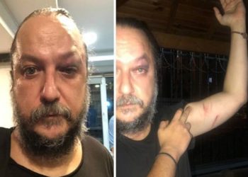 Opera sanatçısı ve yazar Güvenç Dağüstün saldırıya uğradı