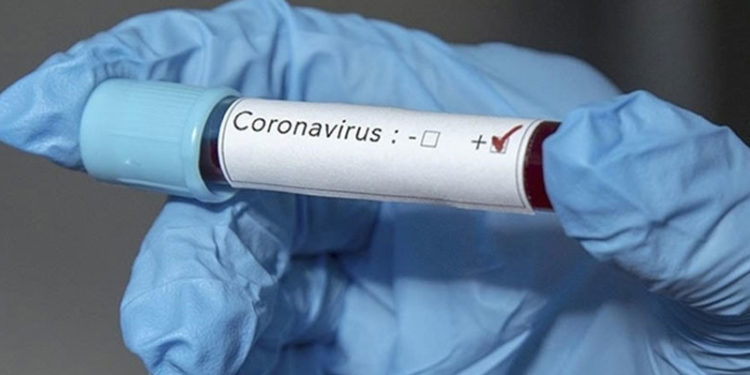 Paralimpik 2020 sporcu semtinde ilk Kovid-19 vakası tespit edildi