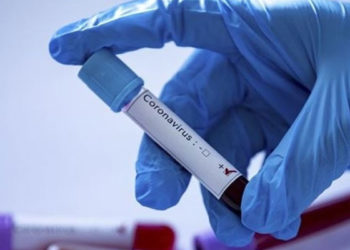 Tokyo Olimpiyatları'na akredite kişilerden Kovid-19'a yakalananların sayısı 259'a çıktı