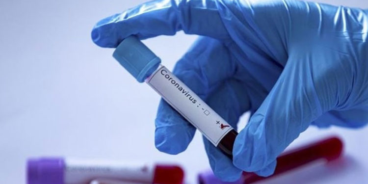 Tokyo Olimpiyatları'na akredite kişilerden Kovid-19'a yakalananların sayısı 259'a çıktı