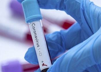 Tokyo Olimpiyatları'na akredite kişilerden Kovid-19'a yakalananların sayısı 382'ye çıktı