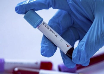 Tokyo Olimpiyatları'na akredite kişilerden Kovid-19'a yakalananların sayısı 404'e çıktı