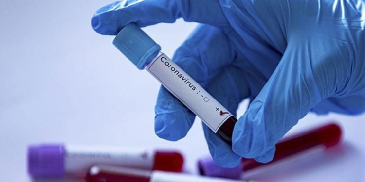 Tokyo Olimpiyatları'na akredite kişilerden Kovid-19'a yakalananların sayısı 404'e çıktı