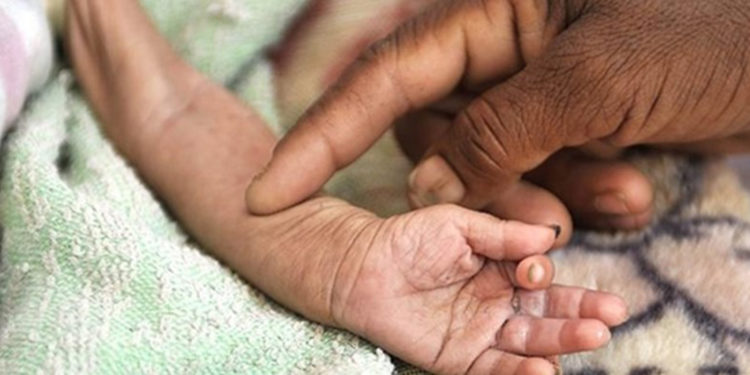 UNICEF: Yemen'de her 10 dakikada bir çocuk yetersiz beslenme ve önlenebilir hastalıklar yüzünden ölüyor