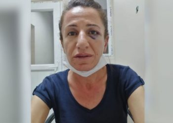 İşkenceye maruz bırakılan Rojbin &Ccedil;etin tutuklandı