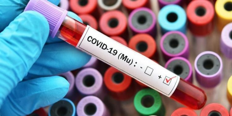 5 soruda Mu varyantı nedir?