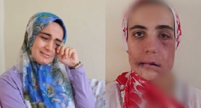 Ayşe Özdoğan: Durumumu daha nasıl anlatayım, almadığım bir ölüm raporu kaldı