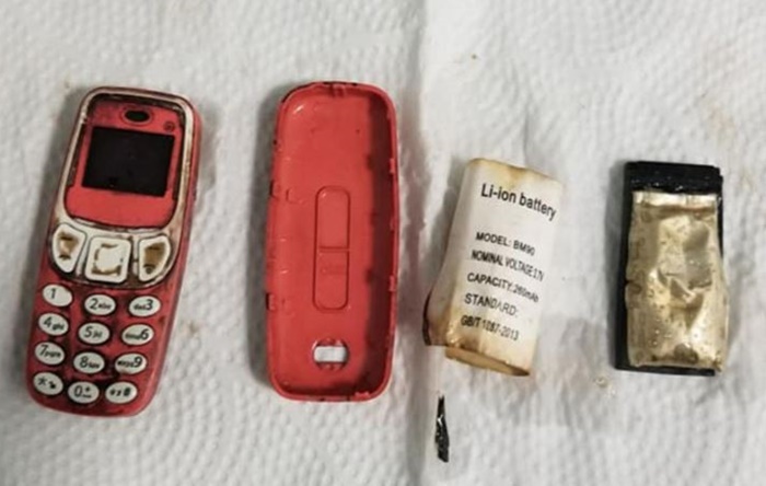 Doktorlar, hastanın midesinden Nokia 3310 çıkardı