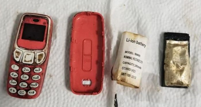 Doktorlar, hastanın midesinden Nokia 3310 çıkardı