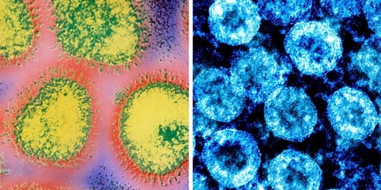 Kış kapıda: Koronavirüsle grip nasıl ayırt edilecek?