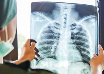 Prof. Kutlu: Hızla yaygınlaşan akciğer kanseri en sık görülen ikinci kanser türü