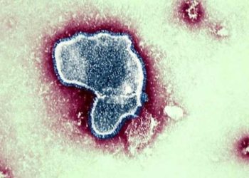 RSV virüsü son dönemde çocuklarda neden daha fazla görülüyor?