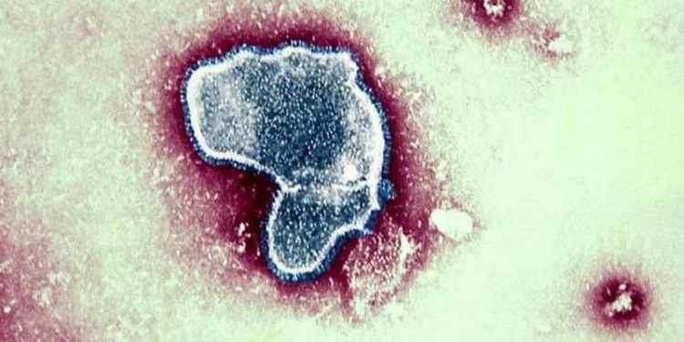 RSV virüsü son dönemde çocuklarda neden daha fazla görülüyor?