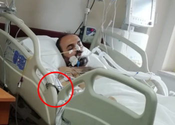 Skandalın fotoğrafları ortaya çıktı; entübe edilen KHK’lı polise 35 gün boyunca kelepçe