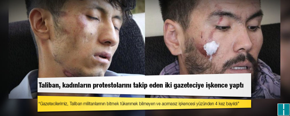 Taliban, kadınların protestolarını takip eden iki gazeteciye işkence yaptı