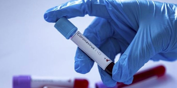 Tokyo Olimpiyatları ile Paralimpik Oyunları boyunca 863 kişi Kovid-19'a yakalandı