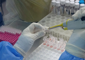 Trabzon'da 'Delta varyantı' alarmı