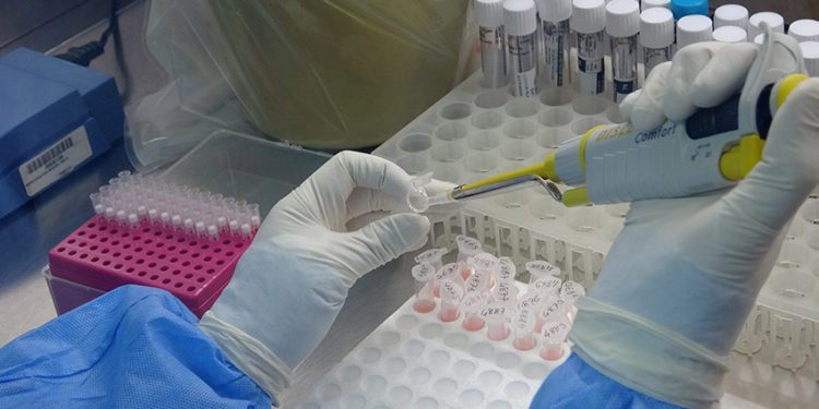 Trabzon'da 'Delta varyantı' alarmı