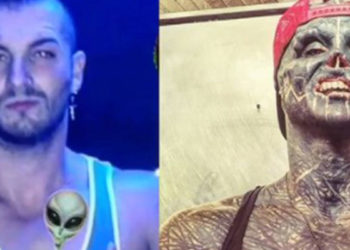 "Uzaylıya dönüşmek" için bıçak altına yattı; burnunu ve kulaklarını aldırdı, dilini ortadan ikiye böldü