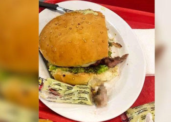 Yediği hamburgerden insan parmağı çıktı!