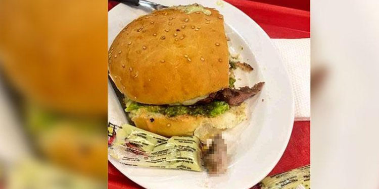 Yediği hamburgerden insan parmağı çıktı!