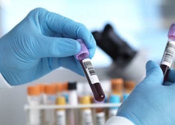 İngiltere'de 50'den fazla kanser türünü erken teşhis etmesi umulan kan testi deneniyor