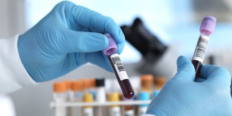 İngiltere'de 50'den fazla kanser türünü erken teşhis etmesi umulan kan testi deneniyor