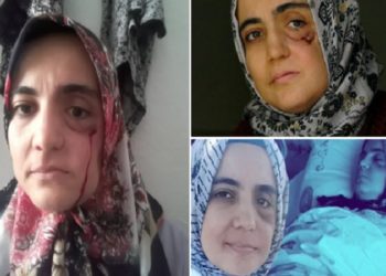 4. evre kanser hastası Ayşe Özdoğan’ın cezaevine atılmasına toplum vicdanı isyan etti