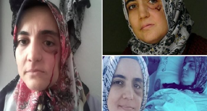 4. evre kanser hastası Ayşe Özdoğan’ın cezaevine atılmasına toplum vicdanı isyan etti