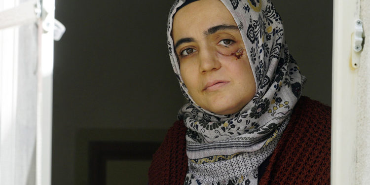 Ablası açıkladı: Ayşe Özdoğan’ın tedaviyi reddettiği haberleri yalan, konsey kararı bekleniyor