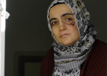 Cemre Birand: Bu öldürmeye teşebbüstür