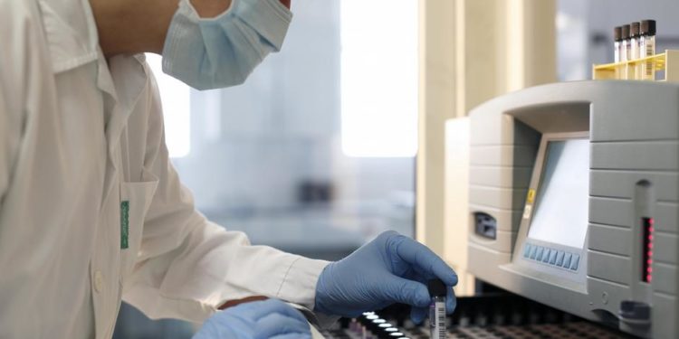 DSÖ: Pandemiyle mücadele edilirken veremden ölenlerin sayısı arttı