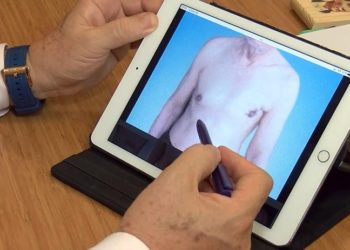 Erkeklerde meme kanseri: Kendilerine konduramıyorlar, o yüzden geç kalınıyor