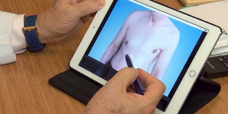 Erkeklerde meme kanseri: Kendilerine konduramıyorlar, o yüzden geç kalınıyor