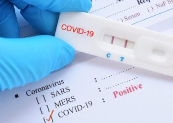 TTB üyesi Yerlikaya: Covid-19 yakalananlara test yapılmamaya başlandı