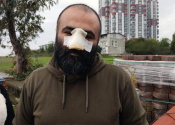 Tasmasız dolaştırılan pitbull, iş insanının burnunu kopardı