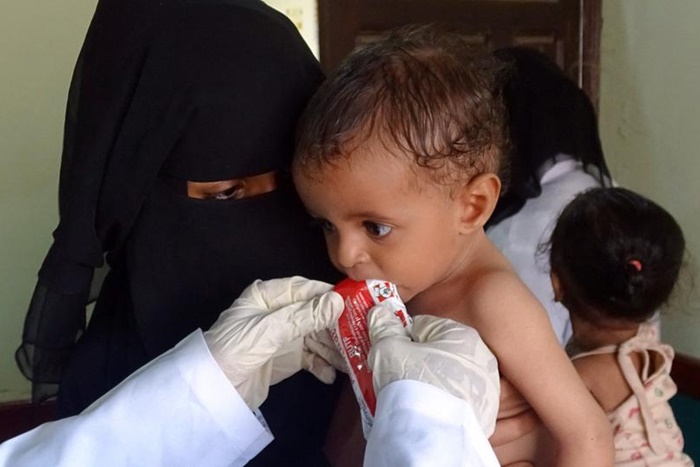 UNICEF: Yemen’de her gün 4 çocuk ölüyor ya da sakat kalıyor