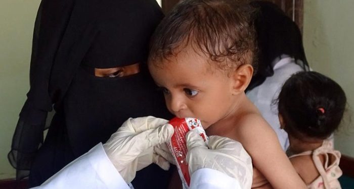 UNICEF: Yemen’de her gün 4 çocuk ölüyor ya da sakat kalıyor