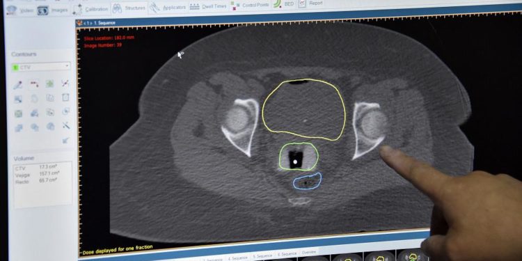Araştırma: İngiltere’de piyasadan çekilen bir aşı rahim ağzı kanserini yüzde 87 düşürüyor