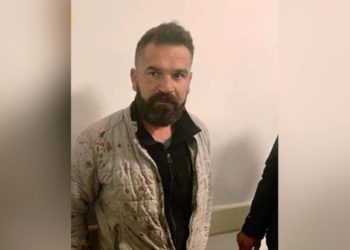 AKP’li Sayan’ın darp ettiği işçi suç duyurusunda bulundu