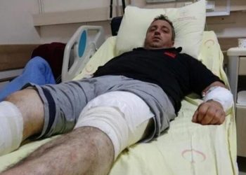 Ayı saldırısından güreşerek kurtuldu: Bacağımı bırakmadı, ben de onu bırakmadım