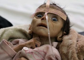 BM: 43 ülkede kıtlık eşiğinde 45 milyon insan var