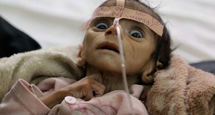 BM: 43 ülkede kıtlık eşiğinde 45 milyon insan var