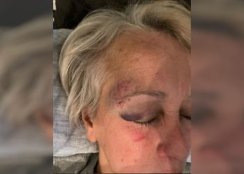 Göbeklitepe'yi keşfeden Klaus Schmidt'in eşi Urfa'da saldırıya uğradı