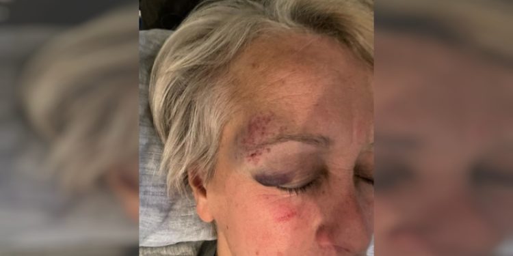 Göbeklitepe'yi keşfeden Klaus Schmidt'in eşi Urfa'da saldırıya uğradı