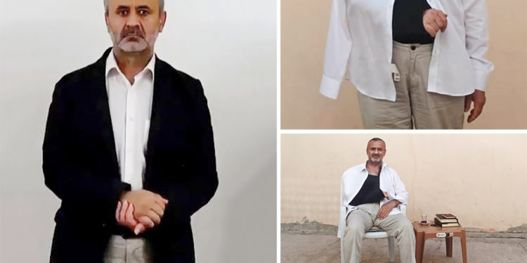 Gözaltında işkence gören Orhan İnandı 6 aydır sağ kolunu kullanamıyor