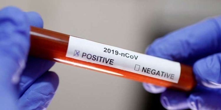 Koronavirüste bugün: 193 kişi daha hayatını kaybetti