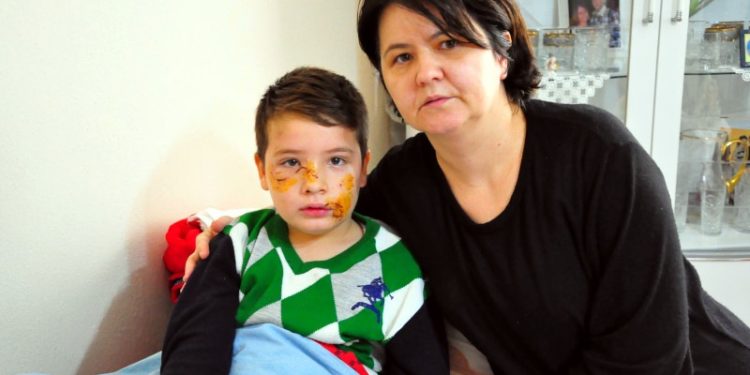 Köpek saldırısına uğrayan çocuğun yüzüne 60 dikiş atıldı