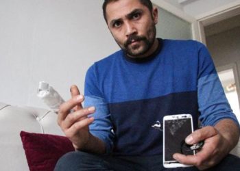 Powerbank bomba gibi patladı, parmağı koptu