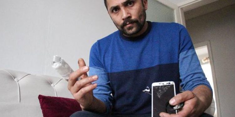 Powerbank bomba gibi patladı, parmağı koptu